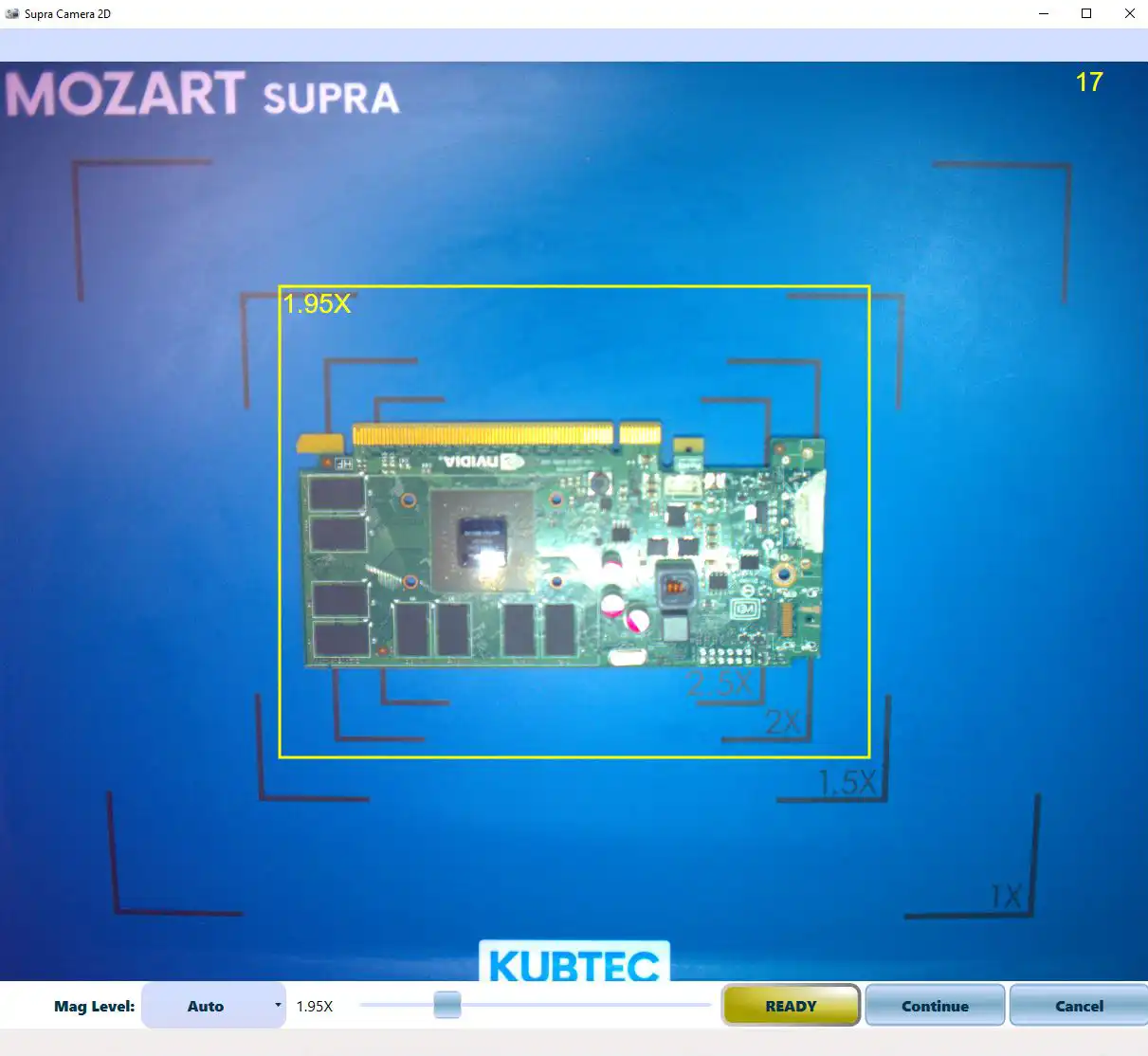 頭蓋底の外科―Standard and modified tec 白馬 明 PARAMETER® Supra Tomosynthesis System | KUBTEC Scientific